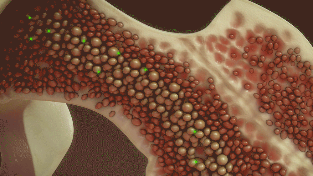 medical animation company / medical animation services